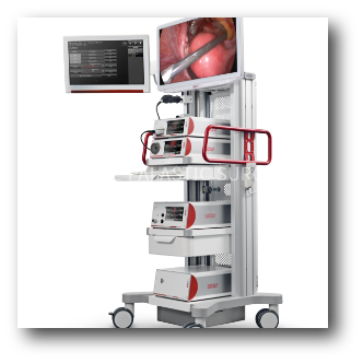 breast_system1.png breast_system1.png