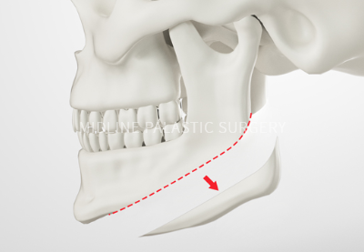 facial-contour_title2.png facial-contour_title2.png