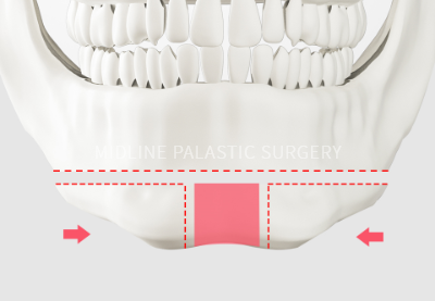 facial-contour_title3.png facial-contour_title3.png