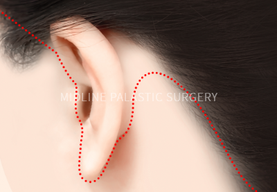 lifting-neck_title2.png lifting-neck_title2.png