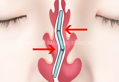 nose-nose_title1.png nose-nose_title1.png
