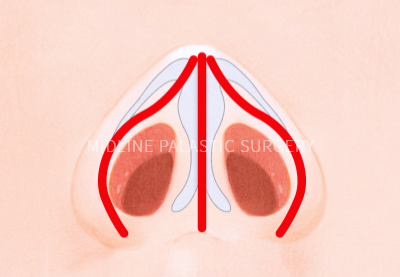 nose-nose_title2.png nose-nose_title2.png