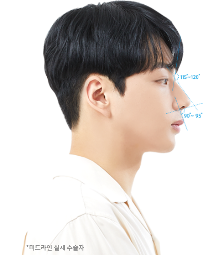nose-type_line2.png nose-type_line2.png