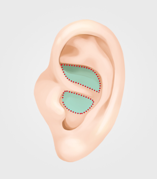nose_material1.png nose_material1.png