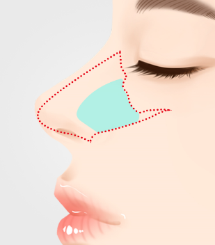 nose_material2.png nose_material2.png