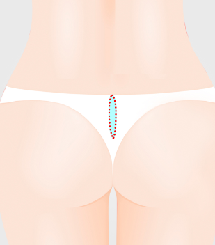 nose_material4.png nose_material4.png