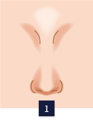 수술 방법