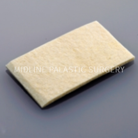 tissue-nose_prosthesis2.png tissue-nose_prosthesis2.png