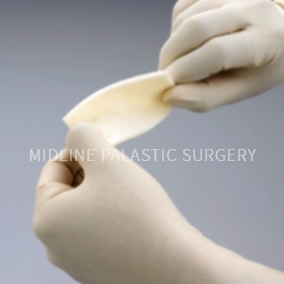 tissue-nose_prosthesis3.png tissue-nose_prosthesis3.png