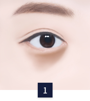 under-eye_necessary1.png under-eye_necessary1.png
