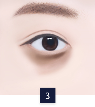 under-eye_necessary3.png under-eye_necessary3.png