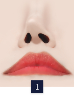 안면목거상 수술 방법