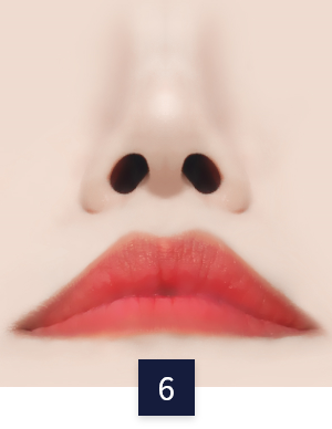 안면목거상 수술 방법