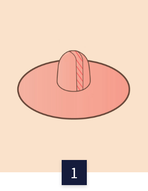 수술 방법
