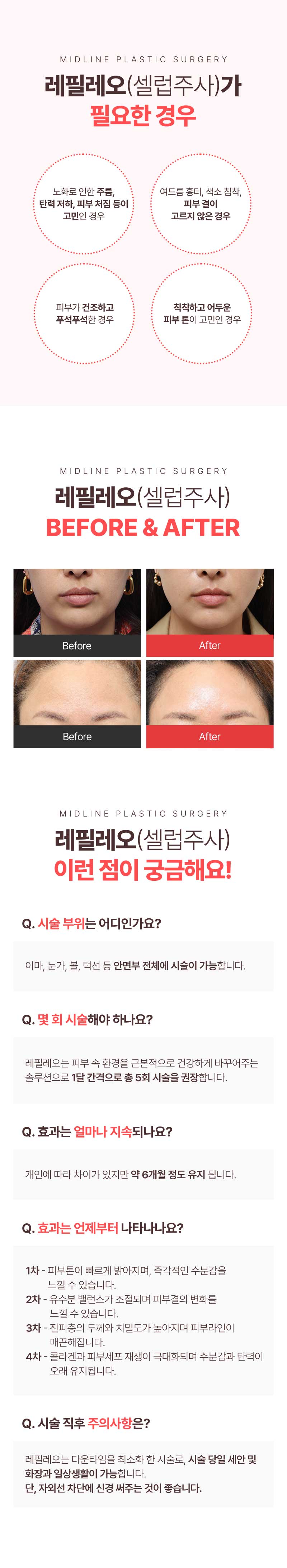 레필레오_MO_최종_04