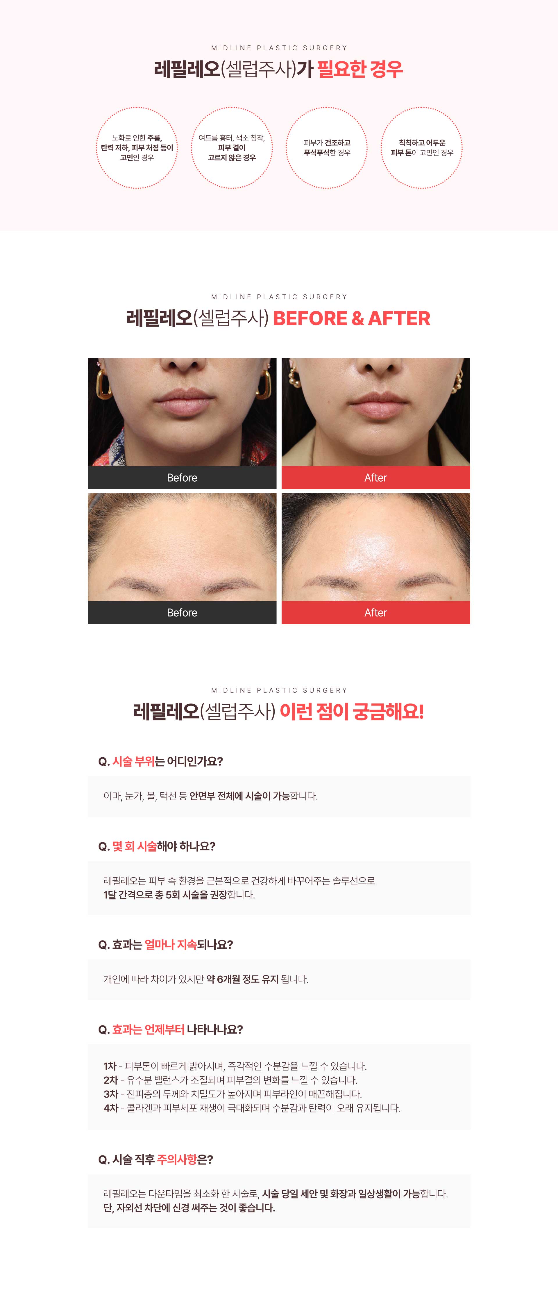 레필레오_PC_최종_05