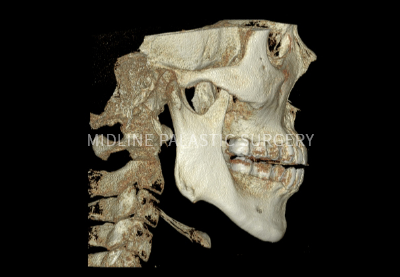 facial-chin_title1.png facial-chin_title1.png