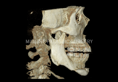 facial-chin_title2.png facial-chin_title2.png