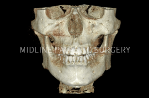 facial-contour_system1.png facial-contour_system1.png