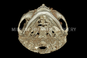 facial-contour_system2.png facial-contour_system2.png