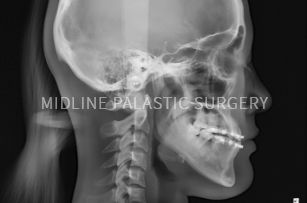 facial-contour_system3.png facial-contour_system3.png