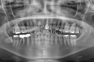 facial-contour_system4.png facial-contour_system4.png