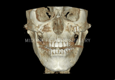 facial-square-jaw_title1.png facial-square-jaw_title1.png