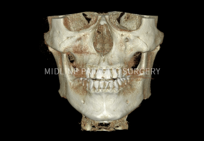 facial-square-jaw_title2.png facial-square-jaw_title2.png