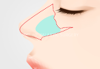 nose-type_title1.png nose-type_title1.png