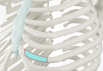 nose-type_title2.png nose-type_title2.png