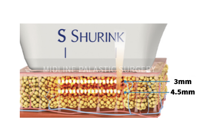 petty-shurink_title1.png petty-shurink_title1.png