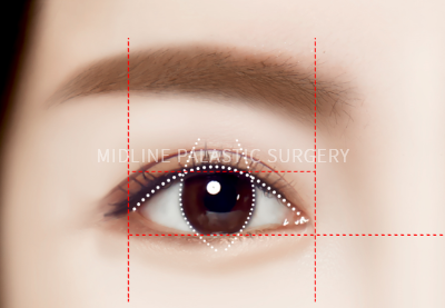 re-eye_title2.png re-eye_title2.png