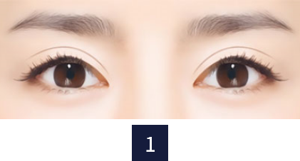 re-eye_type1.png re-eye_type1.png
