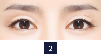 re-eye_type2.png re-eye_type2.png