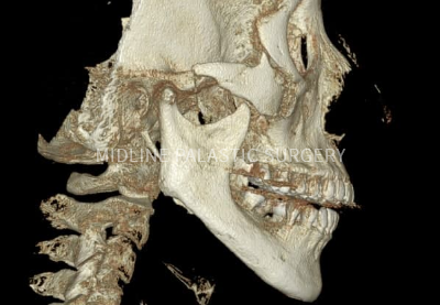 re-facial-contour_title1.png re-facial-contour_title1.png