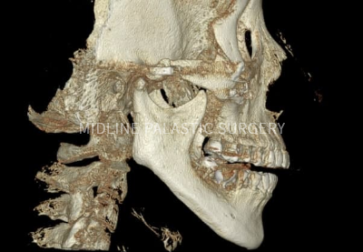 re-facial-contour_title2.png re-facial-contour_title2.png