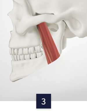 square-jaw_method3.png square-jaw_method3.png