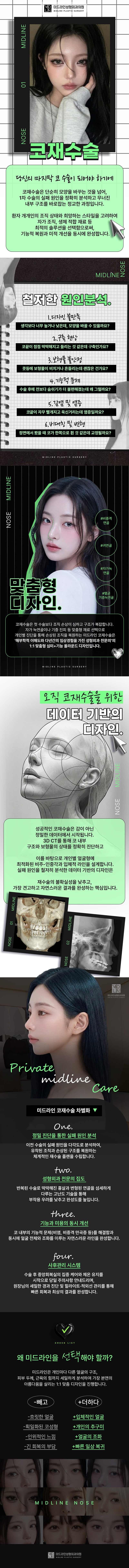 코재수술 설명 이미지