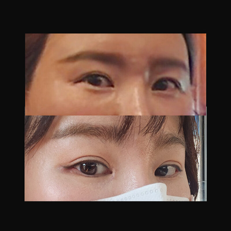 #멀티내시경이마거상