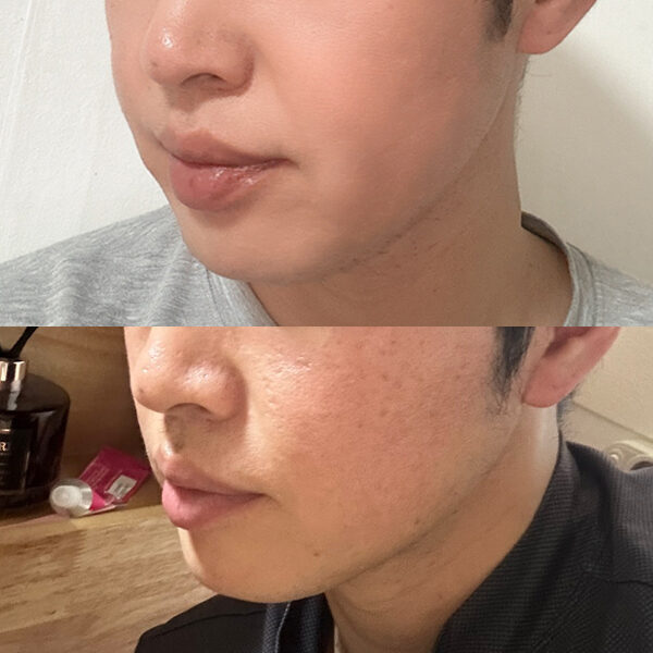 #미드업리프팅