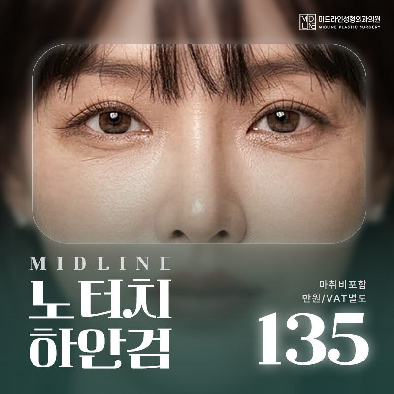 노터치 하안검