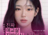 진짜 애교살 지방이식