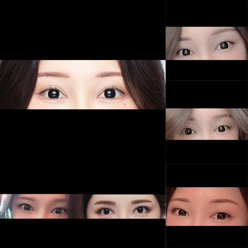 #2040이마거상#내시경이마거상술