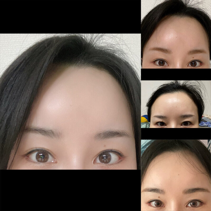 #2040이마거상#뒤트임