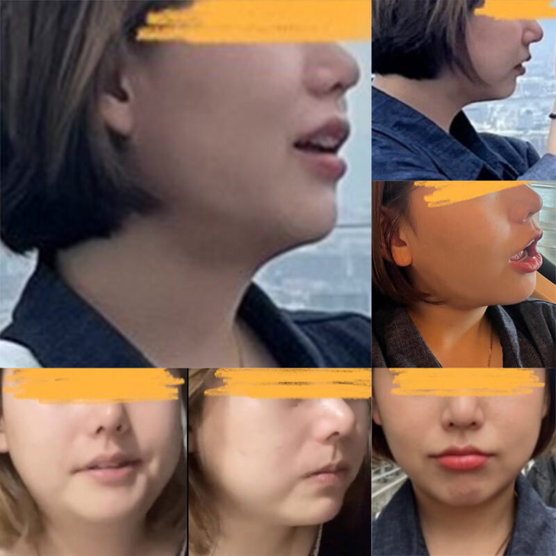 #2040미드업