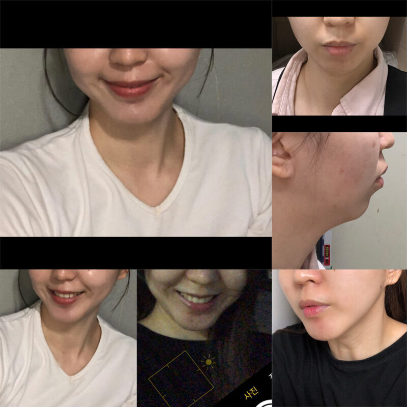 #기능턱전진