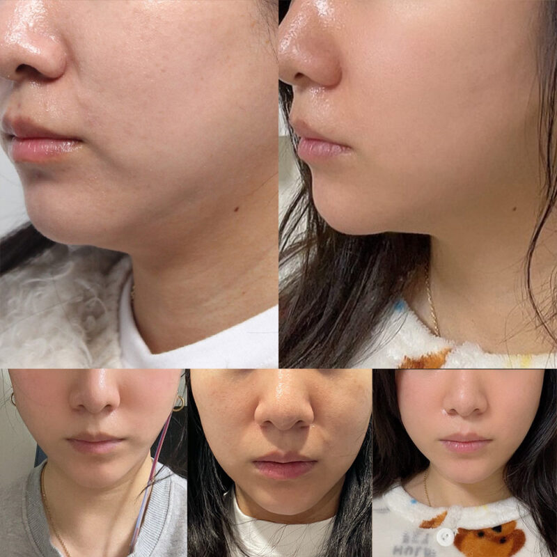 #5060미드업리프팅
