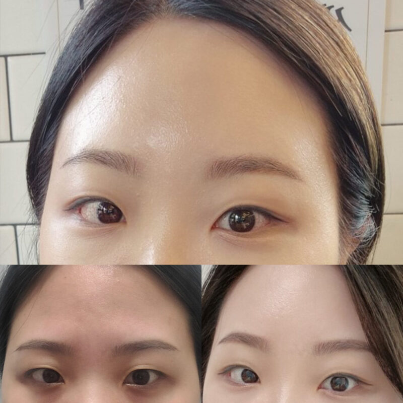 #5060이마거상