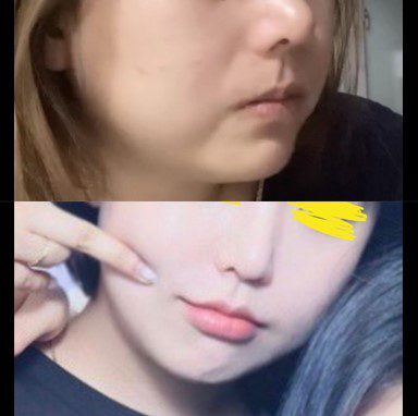 #2040미드업리프팅